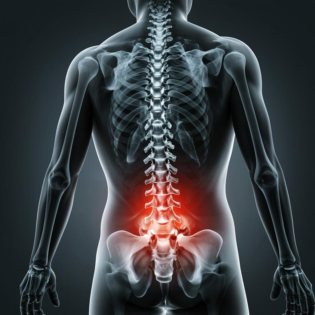 При каких заболеваниях спины нужен специальный матрас?